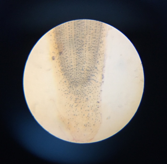 31_OnionApStem